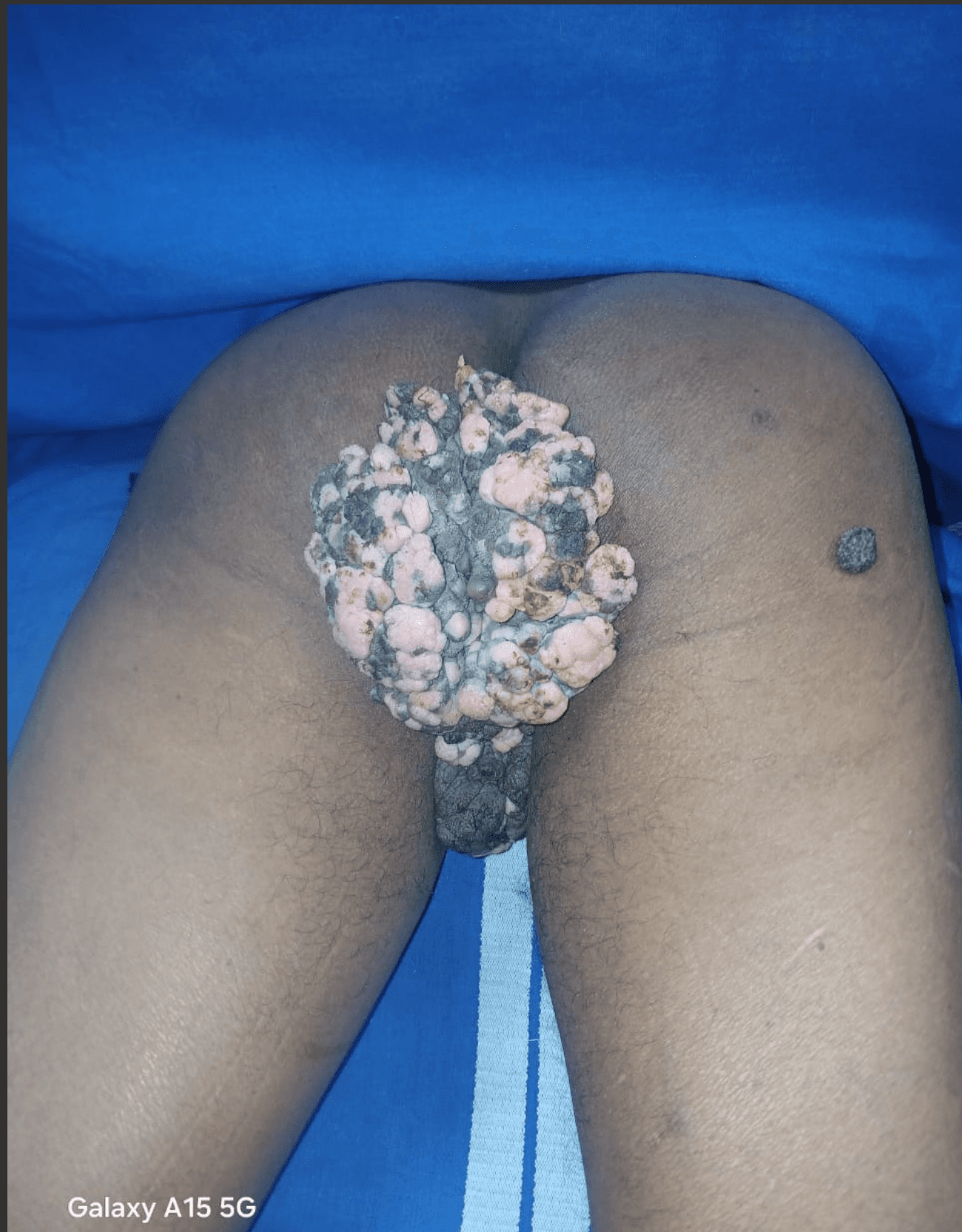Before Treatment