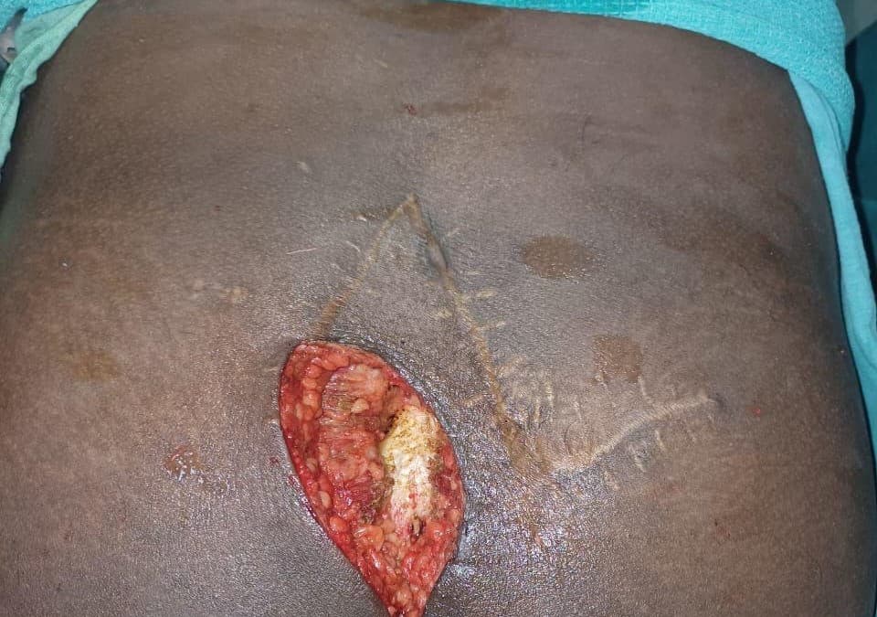 Before Treatment