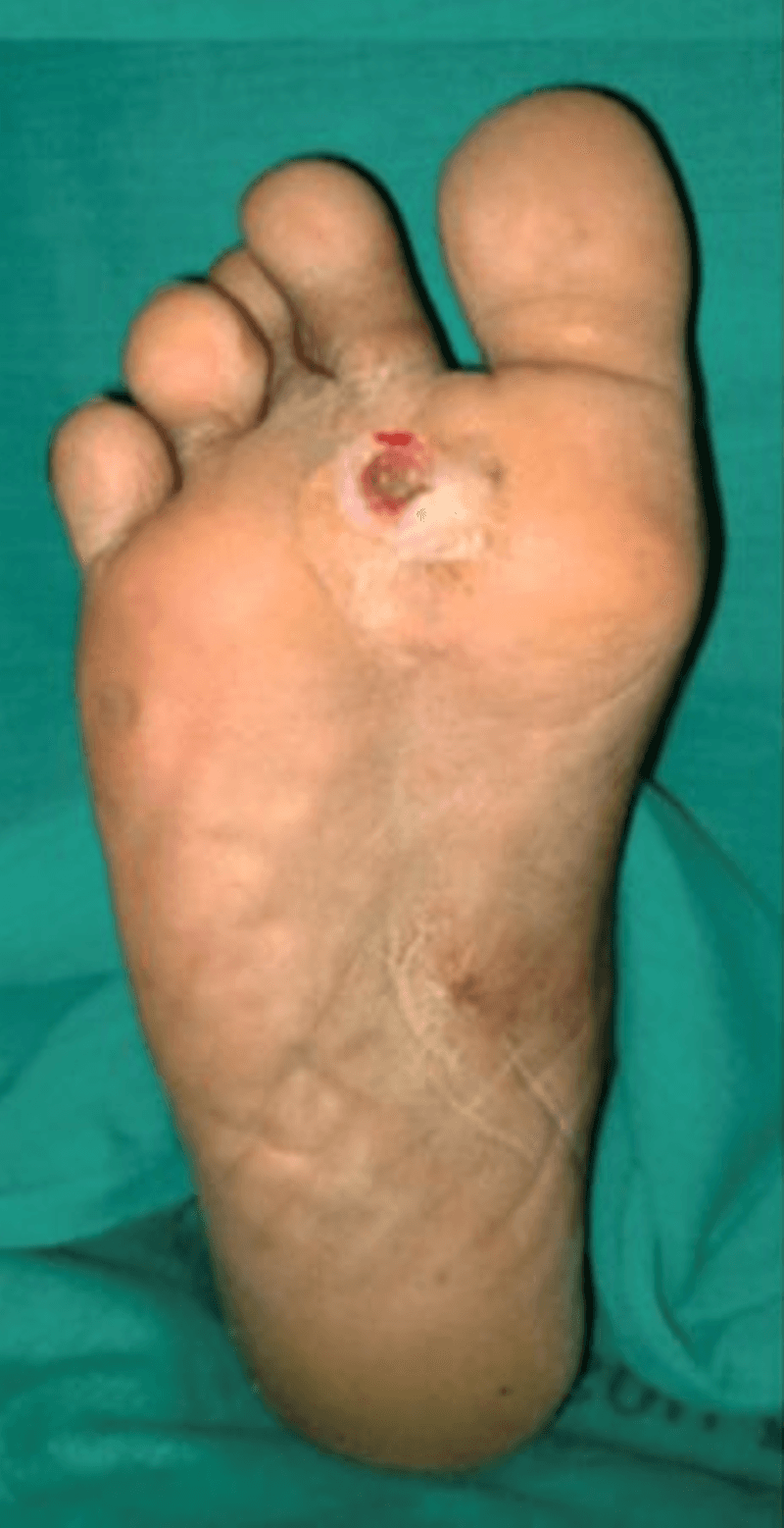 Before Treatment