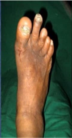 After Healing