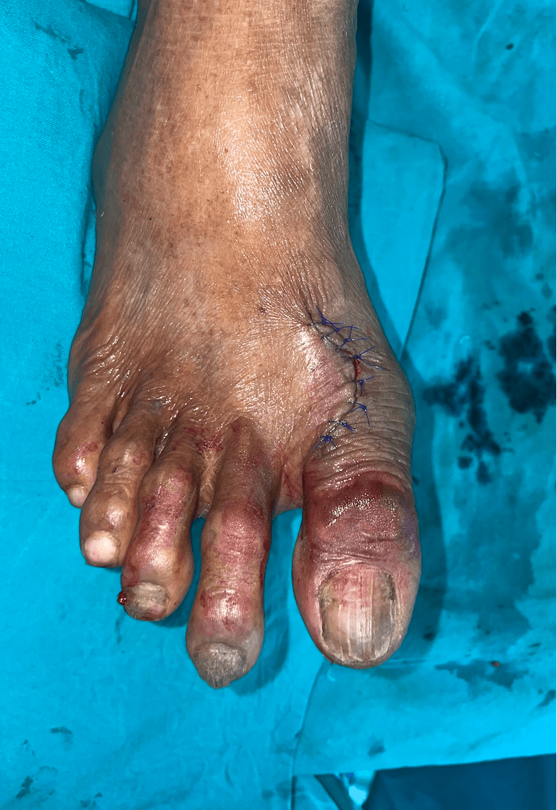 After Healing