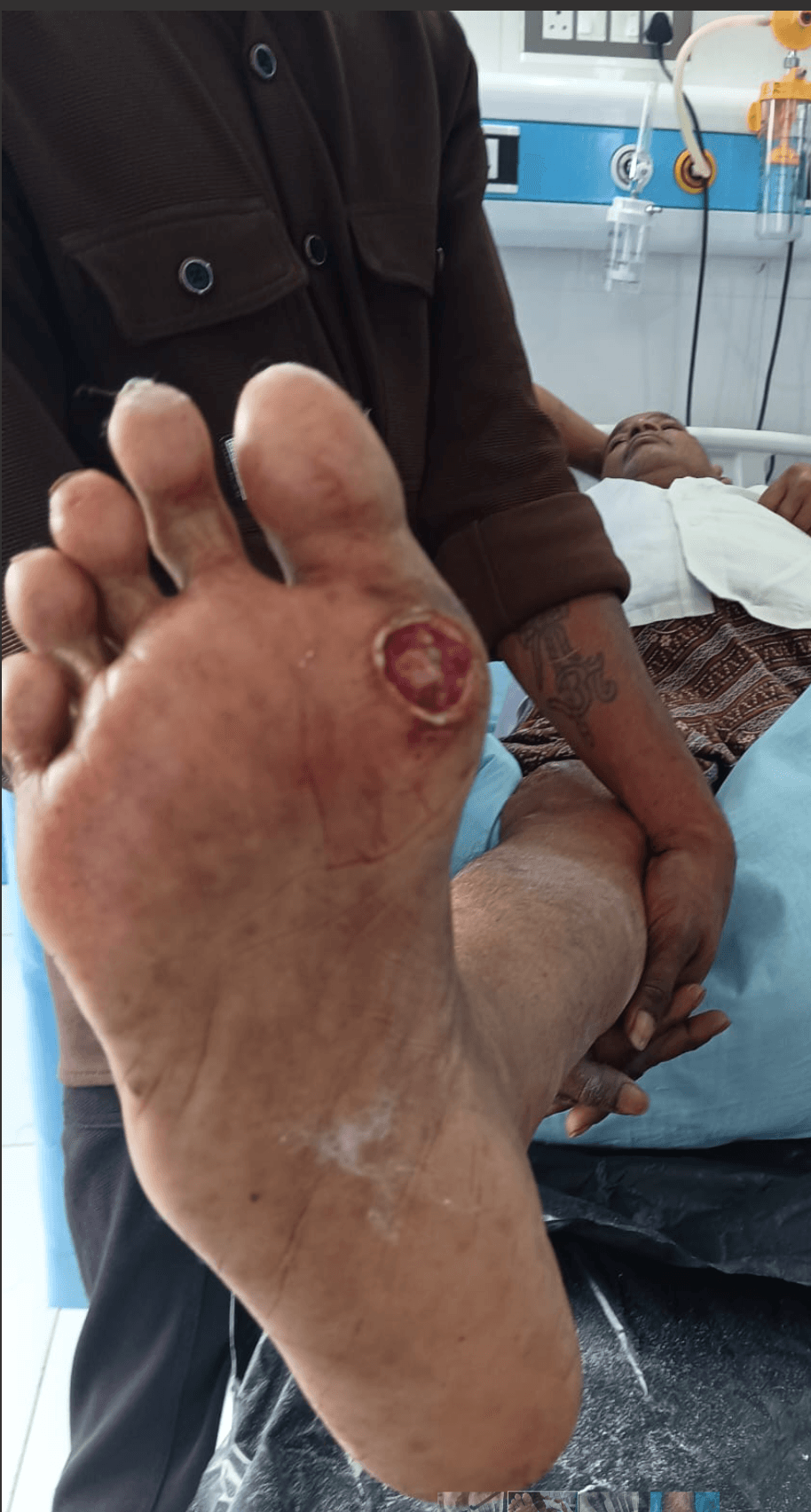 Before Treatment