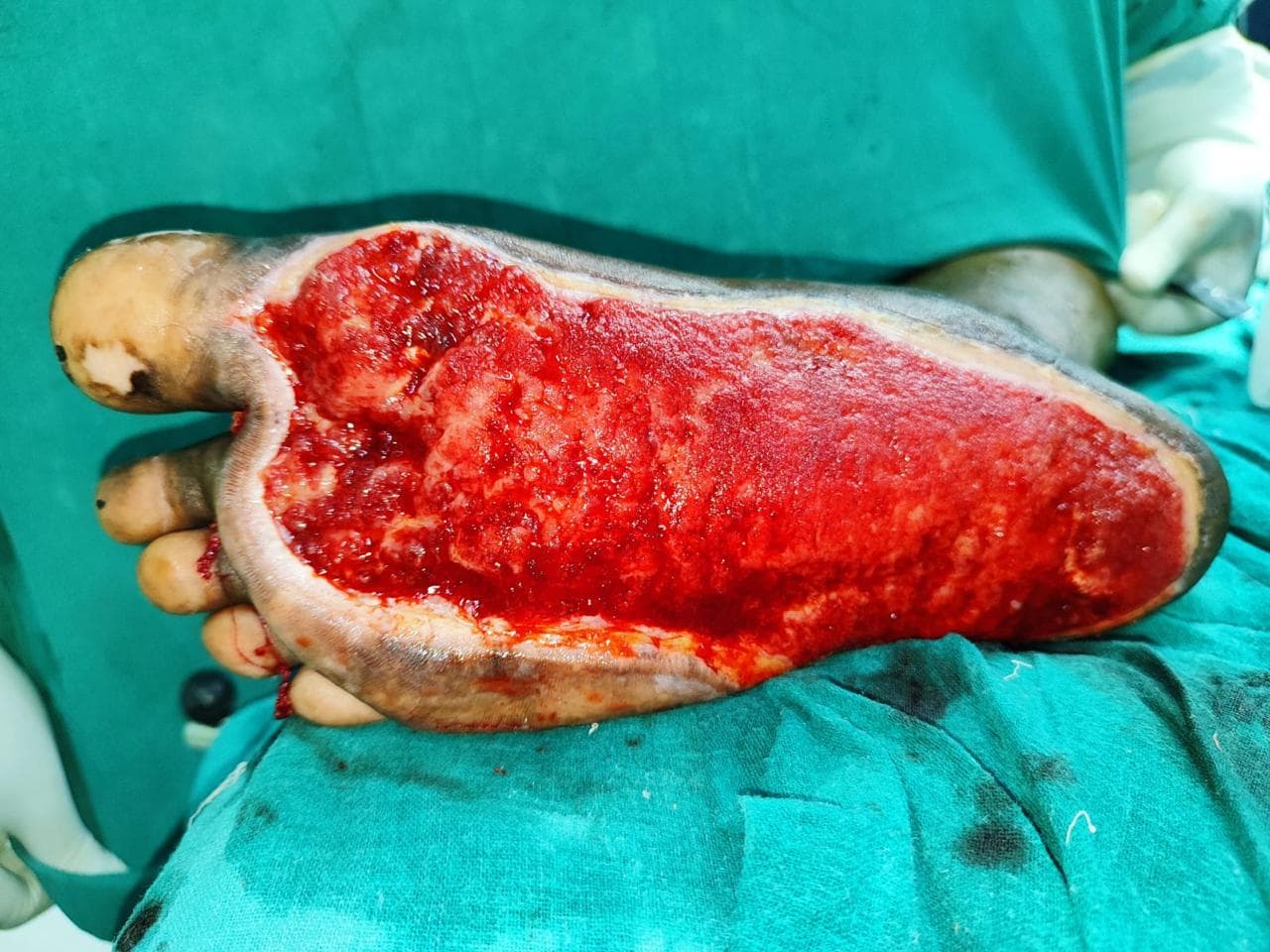 Before Treatment