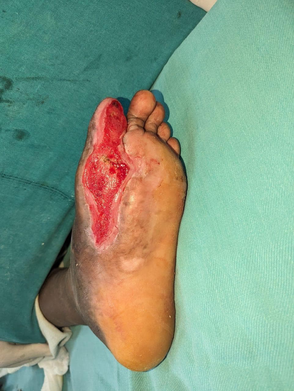 Before Treatment
