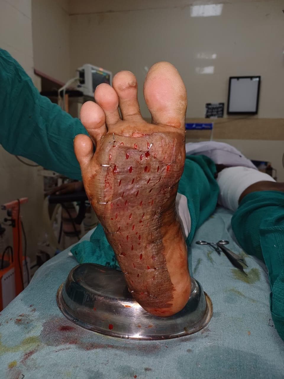 After Healing