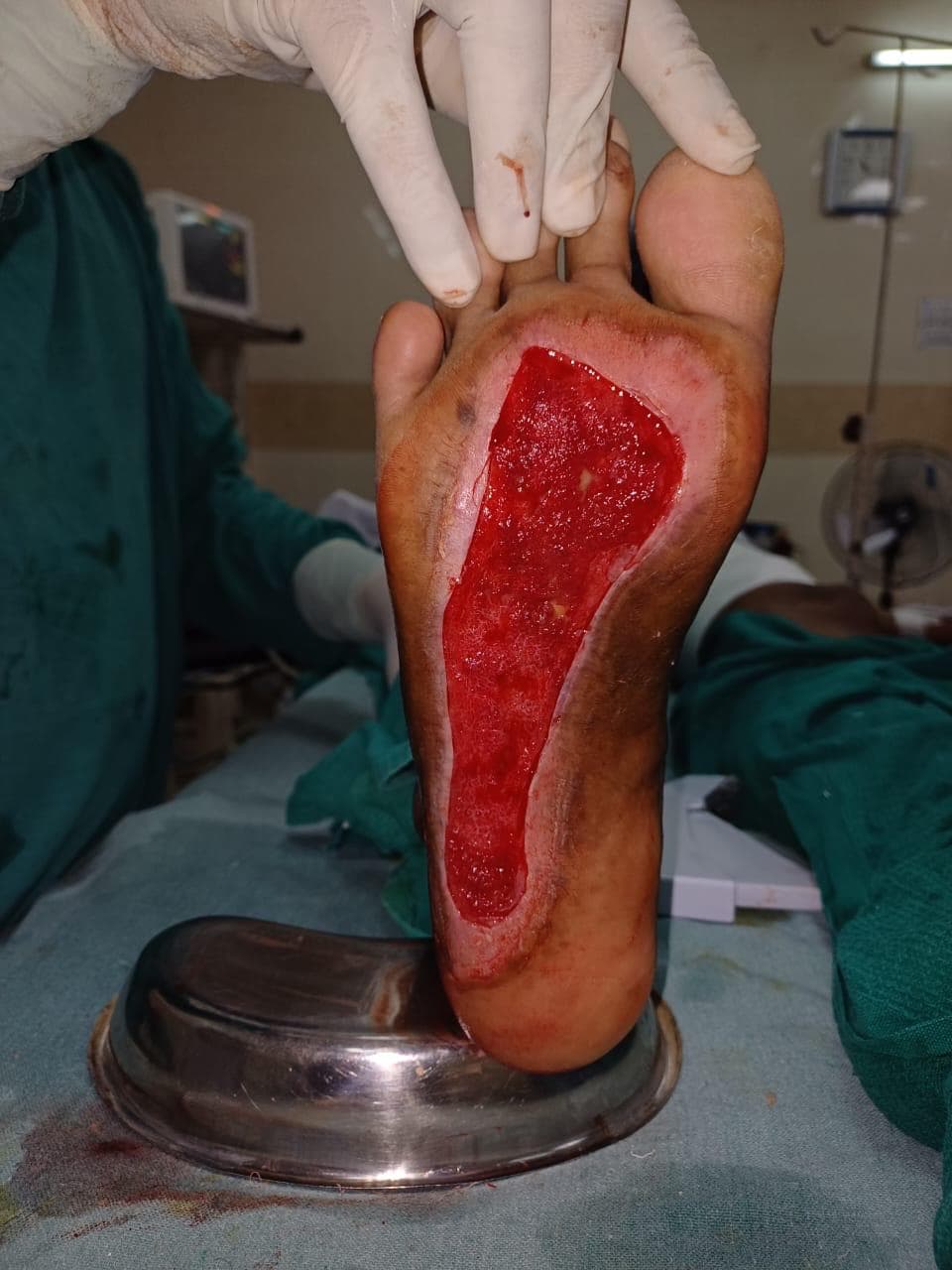 Before Treatment
